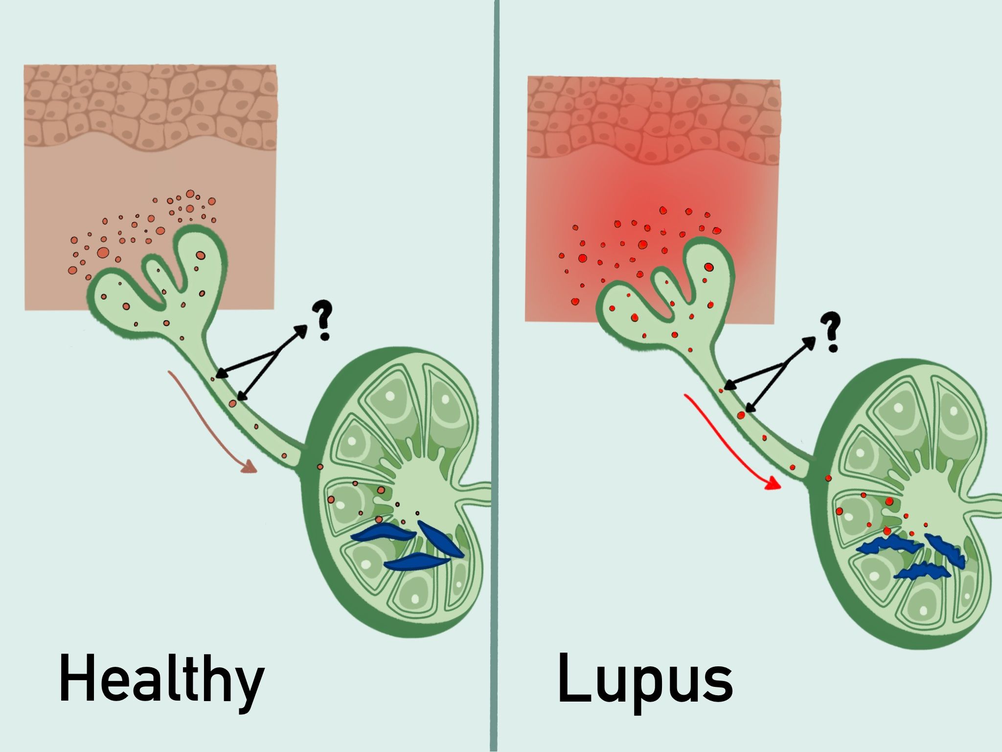 skin-to-lymph_node_axis